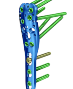 PHILOS – Sistema de osteosíntesis para fracturas proximales de húmero