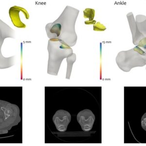 Biotechpromed – Terapias de Preservación Articular