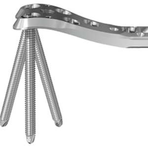 VA Condylar Plate – Placa condilar bloqueada de ángulo variable