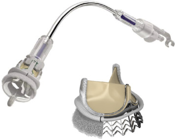 Surgical Valves – Advanced Bioprosthetic Cardiac Valve Line - Image 6